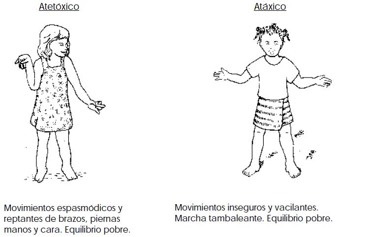 Fomento del Desarrollo del Niño con Parálisis Cerebral, Cuadro de presentación de la afección