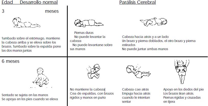 Fomento del Desarrollo del Niño con Parálisis Cerebral, Reconocer el desarrollo del niño