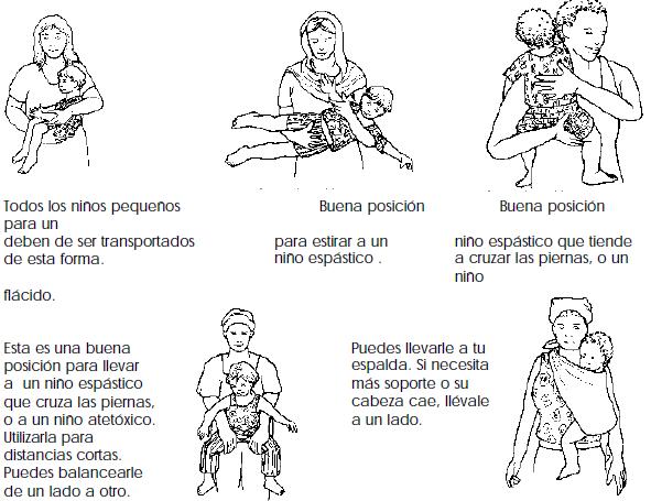 Fomento del Desarrollo del Niño con Parálisis Cerebral (OMS), Manejo adecuado del niño