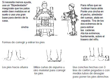 Fomento del Desarrollo del Niño con Parálisis Cerebral (OMS), Para prevenir las deformidades